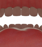 Froggy Mouth: מכשיר מהפכני לטיפול בתפקוד שרירי הפנים, השפתיים והלשון-תמונה